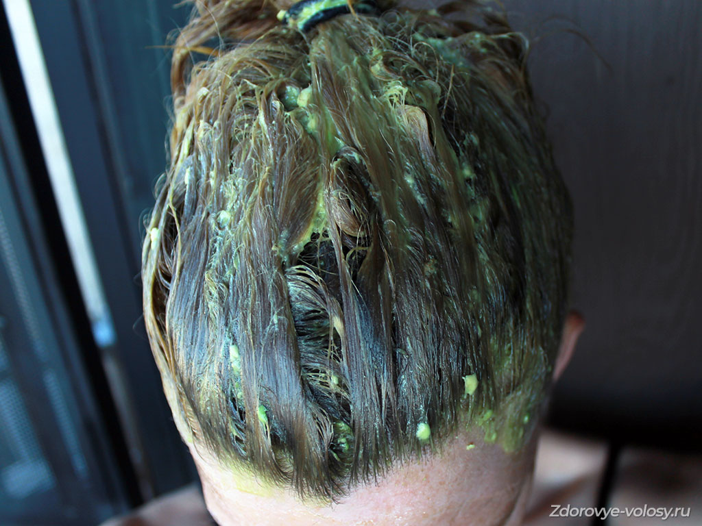 Как бороться с выпадением волос при помощи крапивы
